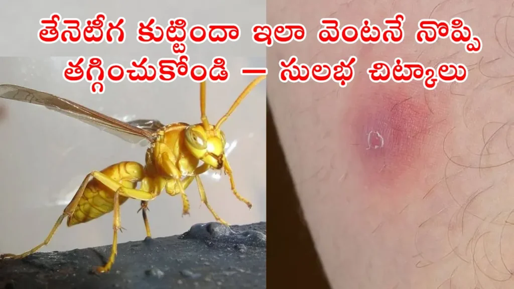 Home Remedies for Bee Sting. How to reduce pain and swelling after bee or wasp bite, with ice pack and clean cloth, in Telugu guide.