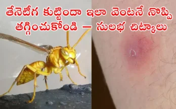 Home Remedies for Bee Sting. How to reduce pain and swelling after bee or wasp bite, with ice pack and clean cloth, in Telugu guide.