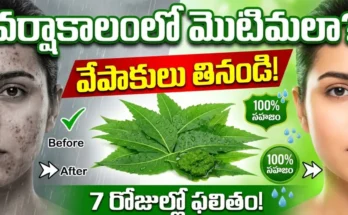 Neem leaves for acne treatment – natural remedy for monsoon skin problems, blood purification, antibacterial benefits.